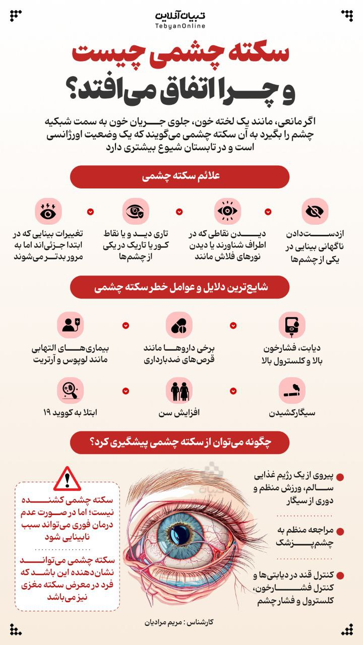 اینفوگرافیک/سکته چشمی چیست و چرا اتفاق می افتد؟ 