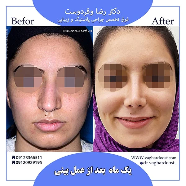 مهم ترین ویژگی جراح بینی خوب چیست؟