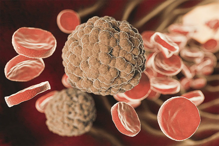 عفونت خون در سالمندان؛ هشدار و مراقبت فوری