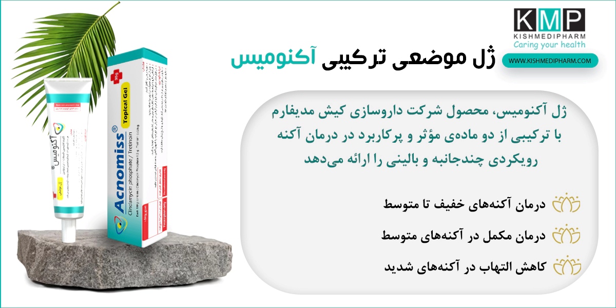 چرا اثر آکنومیس بیشتر از مجموع اجزای آن است؟
