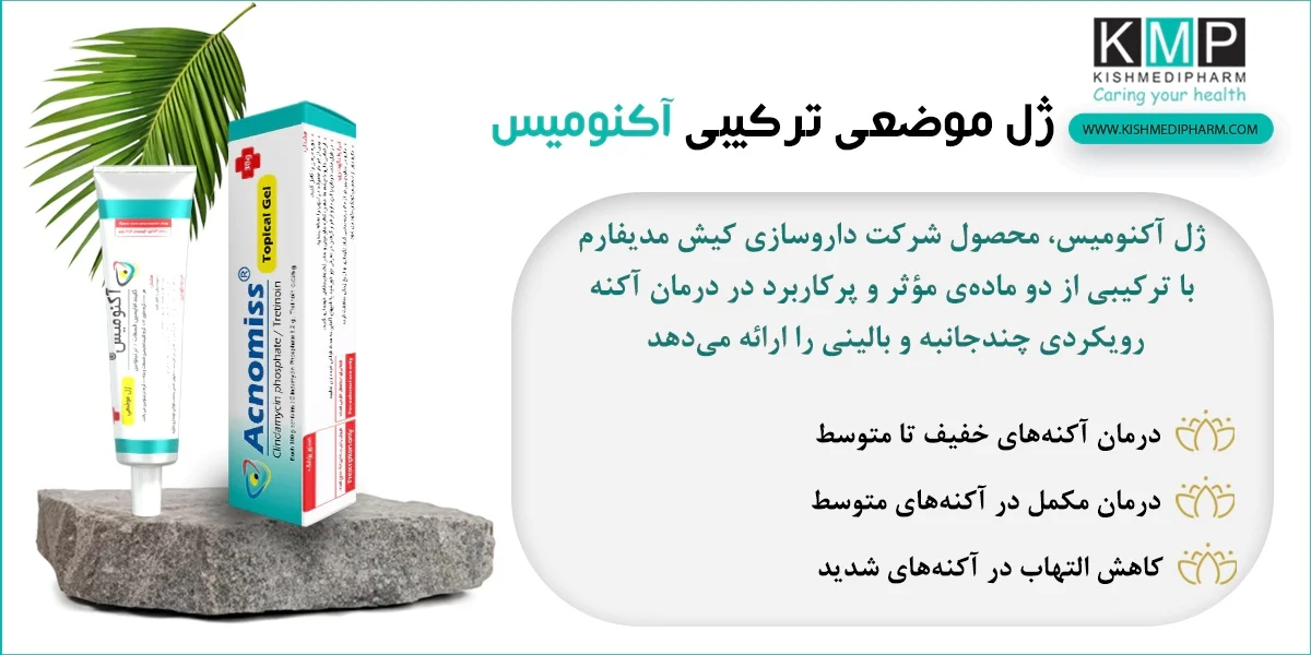 چرا اثر آکنومیس بیشتر از مجموع اجزای آن است؟